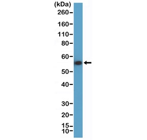 Western blot testing of human HeLa cell lysate using recombinant Keratin 7 antibody at 1:10,000 dilution. Predicted molecular weight ~51