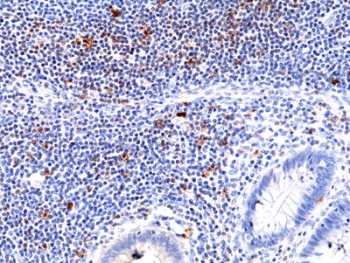 IHC staining of FFPE human appendix tissue with recombinant ICOS antibody at 1:100.~