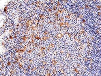 IHC staining of FFPE human tonsil tissue with recombinant IL2RA antibody at 1:200.~