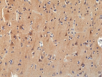 IHC staining of FFPE human brain tissue with recombinant Pan TRK antibody at 1:100.~
