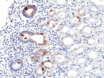 IHC staining of FFPE human stomach tissue with recombinant Helicobacter pylori antibody at 1:100.~
