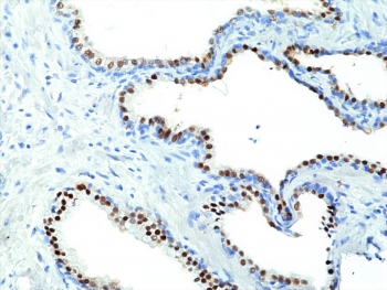 IHC staining of FFPE human prostate tissue with recombinant NKX3.1 antibody at 1:200.~