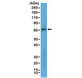 Western blot testing of human MDA-MB-231 cell lysate with recombinant CD73 antibody at 1:1000. Predicted molecular weight: 60-70 kDa.~