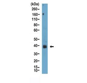 Western blot testing of human prostate tissue lysate with Podoplanin antibody at 1:100. Predicted molecular weight: 25-36 kDa depending on glycosylation level.~