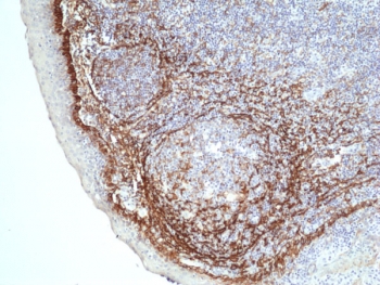 IHC staining of FFPE human tonsil tissue with recombinant Podoplanin antibod