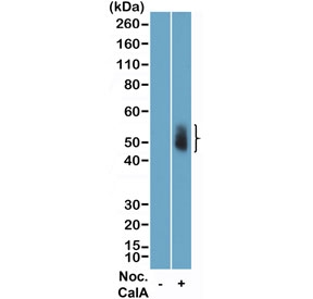 Western blot testing of lysate of human HeLa cells, non-treated (-) or treated (+) with Nocodazole and Calyculin A, using recombinant phospho-Aurora A/B/C antibody at a 1:2500 dilution.~