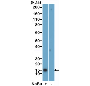 Western blot testing of acid extracts of HeLa cells, treated (+) or untreated (-) with sodium butyrate, using H2BK5ac antibody at 0.02 ug/ml.~
