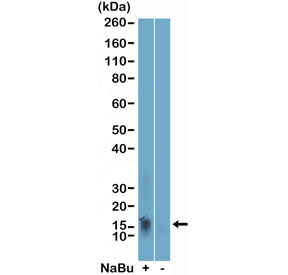 Western blot testing of acid extracts of HeLa cells, treated (+) or untreated (-) with sodium butyrate, using H2BK11ac antibody at 0.002 ug/ml.~