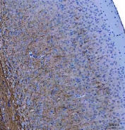 IHC staining of FFPE mouse brain tissue with Light Chain Neurofilament antibody. HIER: boil tissue sections in pH8 EDTA for 20 min and allow to cool before testing.