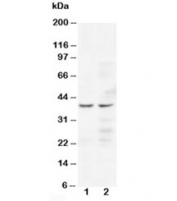 Western blot testing of CCR5 antibody and human Lane 1:  Jurkat;  2: COLO320 cell lysate. Predicted/observed molecular weight ~41 kDa.