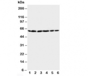 Western blot testing of HSP60 antibody and Lane 1:  rat brain;  2: rat liver;  3: CEM;  4: HeLa;  5: SMMC-7721;  6: COLO320 cell lysate
