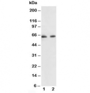 Western blot testing of p65 antibody and Lane 1:  human colon cancer;  2: HeLa lysate. Expected molecular weight ~65 kDa.