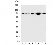 Western blot testing of b-Catenin antibody and Lane 1:  rat brain;  2: rat heart;  3: rat testis;  4: human MCF-7;  5: (h) HeLa;  6: (h) M453;  7: (h) M231;  8: (h) HT1080 cell lysate. Predicted molecular weight ~85 kDa, but routinely observed at 90-95 kDa.