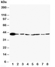 Western blot testing of ERK2 antibody and Lane 1:  rat brain;  2: rat lung;  3: rat placenta;  4: HT1080;  5: HeLa;  6: MM231;  7: Raji;  8: COLO320 cell lysate. Predicted/observed molecular weight: ~41kDa.