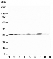 Western blot testing of Connexin 32 antibody and Lane 1:  rat heart;  2: (r) heart;  3: (r) skeletal muscle;  4: (r) brain;  5: human MCF-7;  6: (h) HeLa;  7: (h) SMMC-7721;  8: (h) Jurkat;  9: (h) COLO320 lysate. Predicted molecular weight ~32 kDa.
