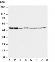 Western blot testing of 5HT2A Receptor antibody and Lane 1:  rat brain;  2: rat brain;  3: mouse brain;  4: mouse brain and human samples  5: U87;  6: SMMC-7721;  7: HT1080;  8: COLO320. Predicted/observed molecular weight ~53kDa.