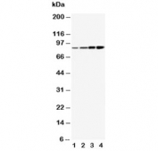 Western blot testing of PI3K antibody and human lysates from 1) MCF-7, 2) HeLa, 3) COLO-320 and 4) SW620 cells. Predicted molecular weight ~85 kDa.