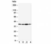 Western blot testing of Podoplanin antibody and Lane 1:  SMMC-7721;  2: 293T;  3: HeLa; Predicted molecular weight ~25/36kDa (unmodified/glycosylated).