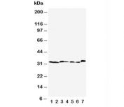 Western blot testing of Caspase-6 antibody  and Lane 1:  rat liver;  2: rat kidney;  3: rat testis;  4: NRK;  5: mouse liver;  6: mouse kidney;  7: mouse testis tissue lysate. Predicted molecular weight: ~33 kDa (precursor).