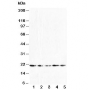 Western blot testing of FGF10 antibody and Lane 1:  U87;  2: HeLa;  3: A549;  4: 293T;  5: HeLa cell lysate. Predicted molecular weight ~23 kDa.