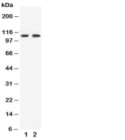 Western blot testing of EphB3 antibody and Lane 1:  HeLa;  2: A549 cell lysate