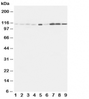 Western blot testing of EphA1 antibody and Lane 1:  rat liver;  2: (r) lung;  3: (r) intestine;  4: (r) ovary;  5: U87;  6: A549;  7: COLO320;  8: SW620;  9: HeLa cell lysate. Predicted molecular weight: ~108kDa.