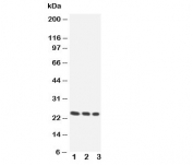 Western blot testing of HOXA6 antibody and Lane 1. SW620, 2. HeLa, 3. HT1080