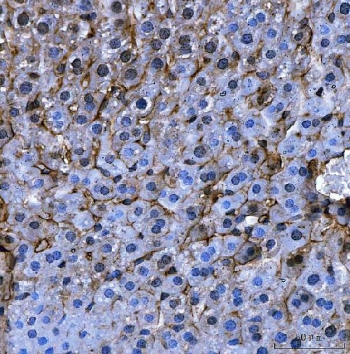 IHC staining of FFPE mouse liver tissue with Angiotensinogen antibody. HIER: boil tissue sections in pH8 EDTA for 20 min and allow to cool before testing.~