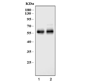 Western blot testing of two lots of mouse liver lysate with Angiotensinogen antibody. Predict