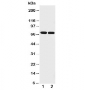 Western blot testing of Netrin 1 antibody and Lane 1:  U87;  2: COLO320 cell lysate.  Expected molecular weight: 68-75 kDa depending on glycosylation level.