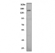 Western blot testing of rat liver tissue lysate with Tlr8 antibody. Expected molecular weight ~120 kDa.