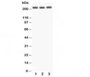 Western blot testing of NOTCH4 antibody and Lane 1:  A549;  2: SMMC-7721;  3: HeLa.  Predicted size: 210KD