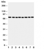 Western blot testing of CYPOR antibody and rat samples: 1. ovary;  2. lung;  3. testis;  4. spleen; and human samples  5. A549;  6.  HeLa;  7. SKOV;  8. MCF-7 cell lysate.  Predicted/observed molecular weight: ~77 kDa.