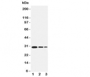 Western blot testing of TRAF1 antbody and recombinant human protein, 30.6KD with tag;  Lane 1: 5ng;  2: 2.5ng;  3: 1.25ng