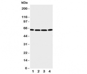Western blot testing of P2X6 antibody and Lane 1:  U87;  2: 22RV1;  3: Jurkat;  4: HT1080 cell lysate.  Expected/observed size 49~70KD depending on glycosylation level