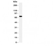 Western blot testing of HIF-3 alpha antibody and rat brain tissue lysate.  Expected/observed size ~72KD