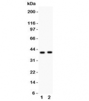 Western blot testing of NDRG2 antibody and Lane 1:  SMMC-7721;  2: PANC lysate.  Expected/observed molecular weight ~41kDa.
