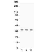 Western blot testing of Calponin antibody and human 1) HeLa, 2) Jurkat, and 3) MCF7 cell lysate. Expected molecular weight ~33 kDa.
