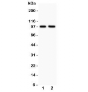 Western blot testing of LFA-1 antibody and Lane 1:  Jurkat;  2: CCRF-CEM lysate;  Predicted/Observed molecular weight: 85~95 kDa depending on glycosylation level.