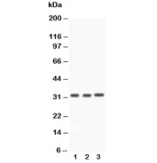 Western blot testing of Caspase-3 antibody and Lane 1:  rat liver;  2: rat thymus;  3: SMMC-7721 lysate. Predicted molecular weight ~32 kDa.