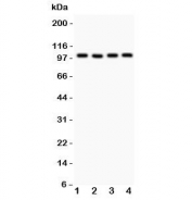 Western blot testing of TRPC7 antibody and Lane 1:  mouse brain;  2: human A549;  3: (h) COLO320;  4: (h) SKOV.  Expected molecular weight ~100 kDa.