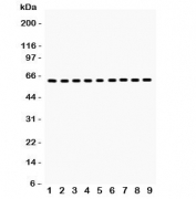 Western blot testing of HSP60 antibody and Lane 1:  rat kidney;  2: mouse kidney;  3: (m) HEPA;  4: (r) NRK;  5: (r) PC12;  6: human SW620;  7: (h) A549;  8: (h) A431;  9: (h) HeLa lysate.  Predicted/observed molecular weight: ~60 kDa.