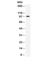 Western blot testing of Jurkat cell lysate with TLR5 antibody. Expected/observed molecular weight ~98 kDa.