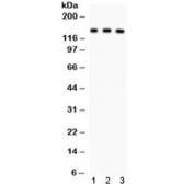 Western blot testing of 1) rat liver, 2) mouse liver and 3) human SMMC lysate with ABCB11 antibody. Expected/observed molecular weight ~146 kDa.
