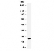 Western blot testing of human MCF7 cell lysate with NAP-2 antibody. Predicted molecular weight: 8~14 kDa.