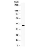 Western blot testing of human COLO320 cell lysate with WNT1 antibody. Expected/observed molecular weight ~41 kDa.