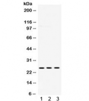 Western blot testing of 1) rat brain, 2) mouse brain and 3) human U87 lysate with PGP 9.5 antibody. Expected/observed molecular weight ~25 kDa.