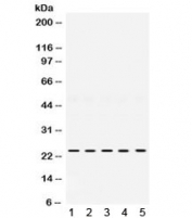 Western blot testing of 1) rat spleen, 2) rat testis, 3) mouse brain, 4) moust thymus, 5) human HeLa lysate with TIMP2 antibody. Expected/observed molecular weight ~24 kDa.