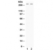 Western blot testing of human 1) HeLa and 2) HepG2 cell lysate with Nestin antibody. Predicted molecular weight ~177 kDa but can be observed at up to 240 kDa.