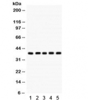 Western blot testing of human 1) MCF7, 2) HeLa, 3) A549, 4) HepG2 and 293 cell lysate with Cdk7 antibody.  Predicted/observed molecular weight ~37 kDa.